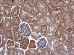 VEGF Antibody in Immunohistochemistry (Paraffin) (IHC (P))