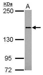 CD100 Antibody in Western Blot (WB)