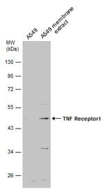 TNFR1 Antibody in Western Blot (WB)