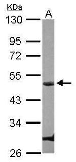 Cyclin E Antibody in Western Blot (WB)