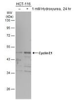 Cyclin E Antibody in Western Blot (WB)