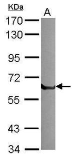 tPA Antibody in Western Blot (WB)