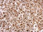 Desmin Antibody in Immunohistochemistry (Paraffin) (IHC (P))