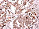 GLB1 Antibody in Immunohistochemistry (Paraffin) (IHC (P))