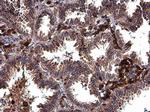 MMP2 Antibody in Immunohistochemistry (Paraffin) (IHC (P))