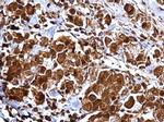 MMP2 Antibody in Immunohistochemistry (Paraffin) (IHC (P))