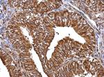 MMP2 Antibody in Immunohistochemistry (Paraffin) (IHC (P))