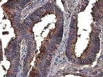 MMP2 Antibody in Immunohistochemistry (Paraffin) (IHC (P))