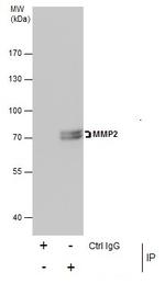 MMP2 Antibody in Immunoprecipitation (IP)