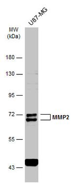 MMP2 Antibody in Western Blot (WB)