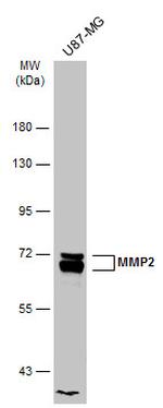 MMP2 Antibody in Western Blot (WB)