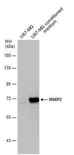 MMP2 Antibody in Western Blot (WB)