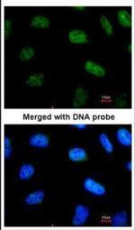 STAT3 Antibody in Immunocytochemistry (ICC/IF)