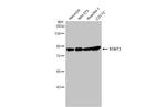 STAT3 Antibody in Western Blot (WB)