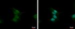 Calcineurin A Antibody in Immunocytochemistry (ICC/IF)