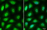 LOXL2 Antibody in Immunocytochemistry (ICC/IF)