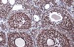 LOXL2 Antibody in Immunohistochemistry (Paraffin) (IHC (P))