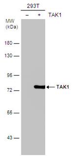 TAK1 Antibody in Western Blot (WB)