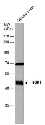 SGK1 Antibody in Western Blot (WB)