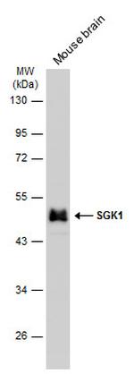 SGK1 Antibody in Western Blot (WB)