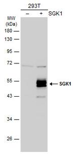 SGK1 Antibody in Western Blot (WB)