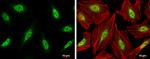 CDK9 Antibody in Immunocytochemistry (ICC/IF)