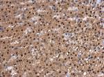 CDK9 Antibody in Immunohistochemistry (Paraffin) (IHC (P))