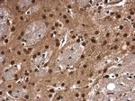 CDK9 Antibody in Immunohistochemistry (Paraffin) (IHC (P))