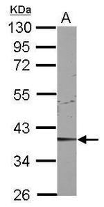 CDK9 Antibody in Western Blot (WB)