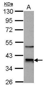 CDK9 Antibody in Western Blot (WB)