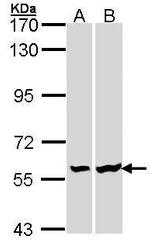 LCK Antibody in Western Blot (WB)