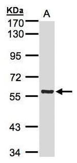 PINK1 Antibody in Western Blot (WB)