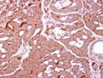 IKK beta Antibody in Immunohistochemistry (Paraffin) (IHC (P))