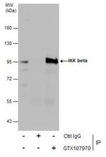 IKK beta Antibody in Immunoprecipitation (IP)