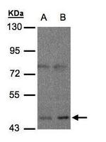 OPRM1 Antibody in Western Blot (WB)