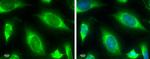 TBK1 Antibody in Immunocytochemistry (ICC/IF)