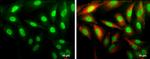 Cyclin D1 Antibody in Immunocytochemistry (ICC/IF)