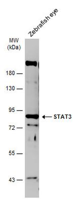 STAT3 Antibody in Western Blot (WB)