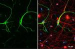 GFAP Antibody in Immunocytochemistry (ICC/IF)