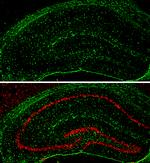 GFAP Antibody in Immunohistochemistry (Frozen) (IHC (F))