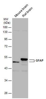 GFAP Antibody in Western Blot (WB)