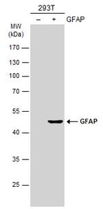 GFAP Antibody in Western Blot (WB)