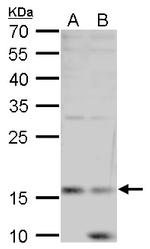 Leptin Antibody in Western Blot (WB)