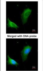 Arginase 1 Antibody in Immunocytochemistry (ICC/IF)