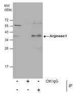 Arginase 1 Antibody in Immunoprecipitation (IP)