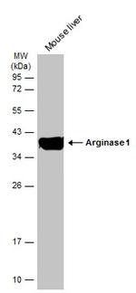 Arginase 1 Antibody in Western Blot (WB)