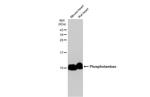 Phospholamban Antibody in Western Blot (WB)