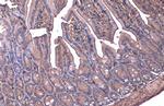 beta Actin Antibody in Immunohistochemistry (Paraffin) (IHC (P))