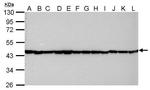 beta Actin Antibody in Western Blot (WB)