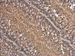 beta Actin Antibody in Immunohistochemistry (Paraffin) (IHC (P))